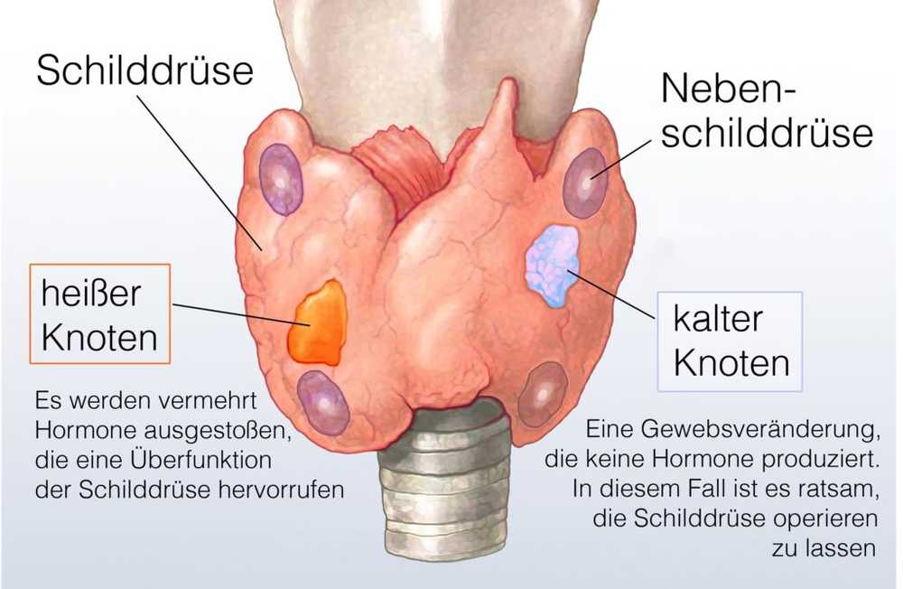 Erhöhte blutwerte